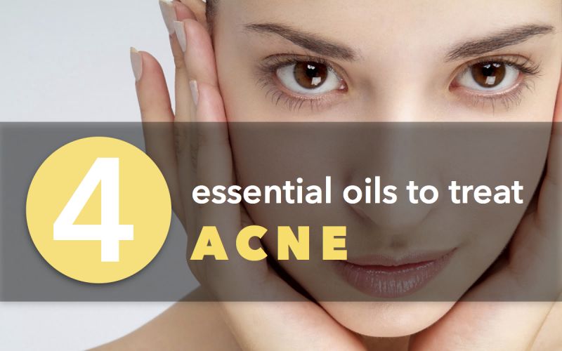 4 Essential Oils That Can Actually Treat Acne