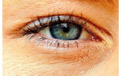 आंखों के चारों ओर सूजन, एनीमिया, गुर्दे की बीमारी के संकेत हो सकते हैं