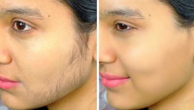 Try these homemade facial to remove unwanted facial hair