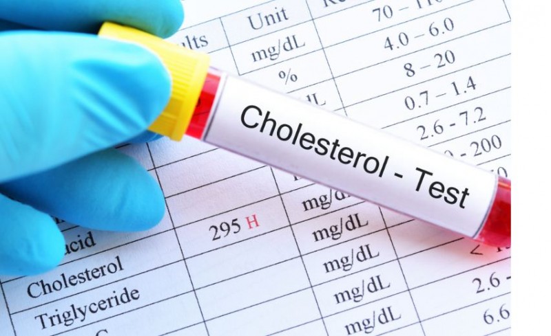 How to Outsmart High Cholesterol Understanding Numbers and Taking Control