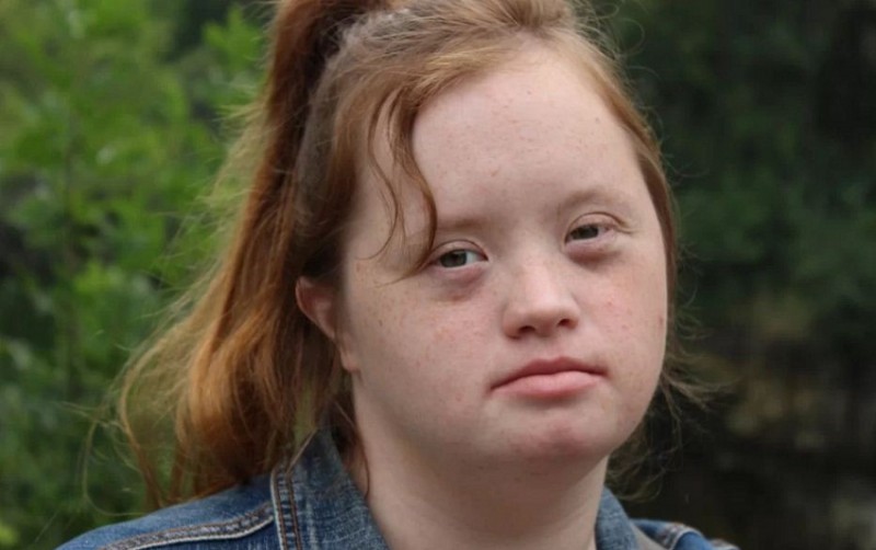 World Down Syndrome Day: Celebrating Abilities and Pushing for Change
