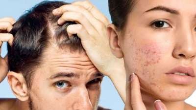 Due to zinc deficiency in the body, these symptoms appear on the skin, immunity may deteriorate