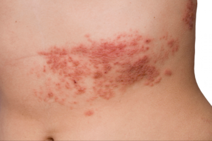 If rashes appear on the skin, do not ignore them, otherwise you will have to worry