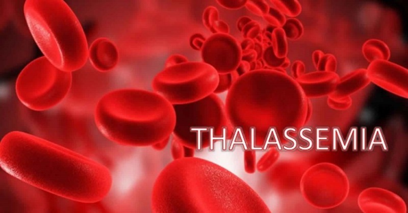 Insights into Thalassemia: Enhancing Quality of Life With Care