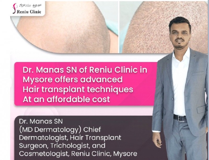 Dr. Manas SN of Reniu Clinic in Mysore offers advanced hair transplant techniques at an affordable cost