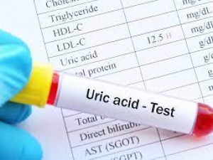 These 5 local things will control increased uric acid, cost less than Rs 10