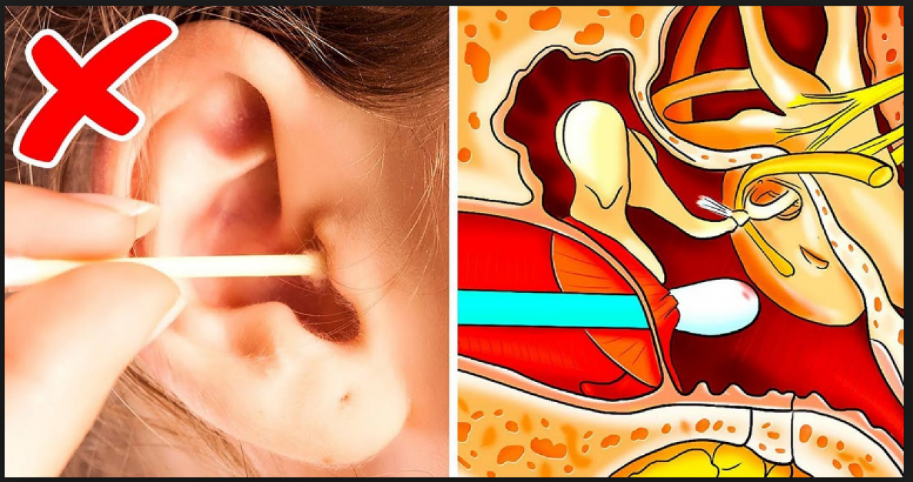 Safe and effective home remedies to remove Earwax