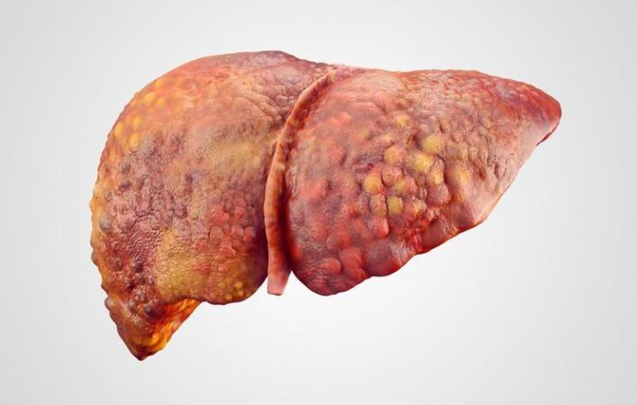 Avoid eating these foods to keep your liver healthy