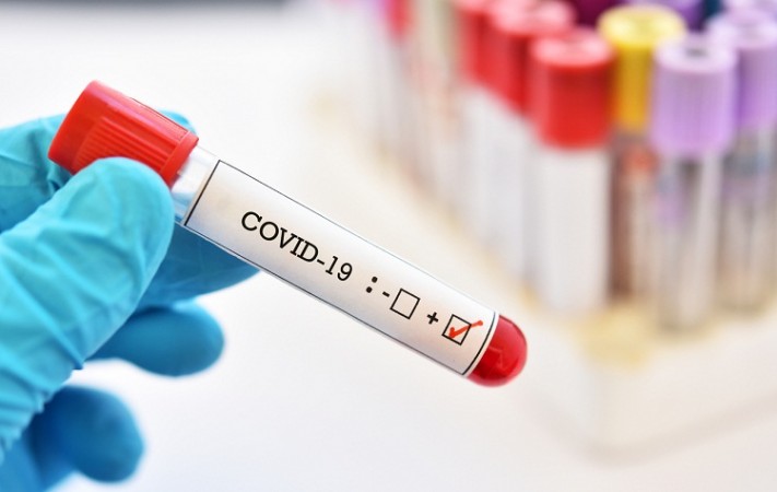 What Researchers say why some patients may test positive for COVID-19 long after recovery?
