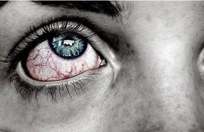 आंखों की इस लाइलाज बीमारी की चपेट में 20 करोड़ लोग, जानिए इससे कैसे जा सकता है बचा