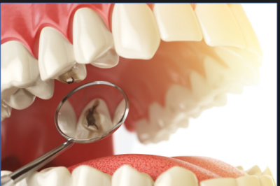 Protect your oral health to delay tooth decay by adopting these tips