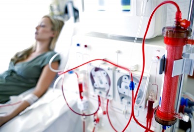 If you do not keep these things in mind after dialysis, it will cause further harm to the body, know
