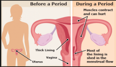 Get to know about the Period pain and its causes
