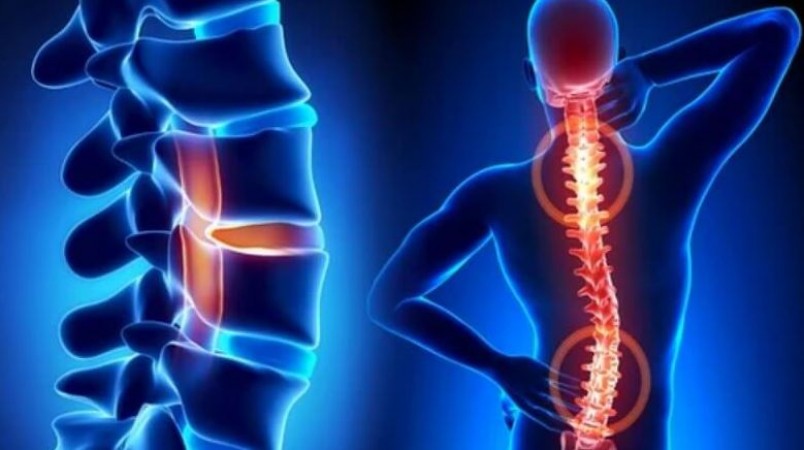 How to Prevent Spine Diseases Caused by These 5 Mistakes, Act Now!