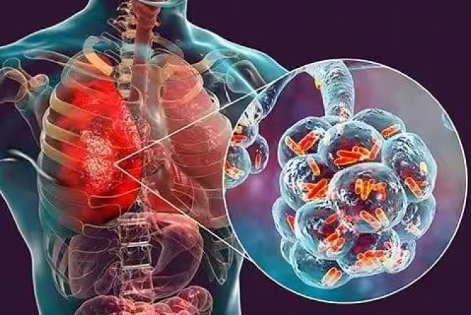 If such problems persist for more than a week, be careful, it may be pneumonia, can take life