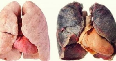 धूम्रपान करने वाले के फेफड़े होते हैं कितने स्वस्थ
