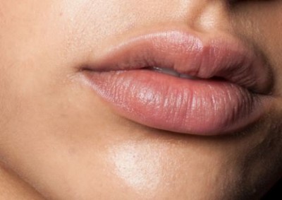 Take care of chapped and dry lips in winter in this way