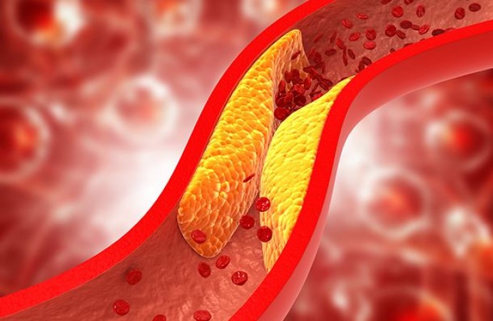 Foods That Can Clear Blocked Veins of Bad Cholesterol in a Few Days – Include Them in Your Diet Today