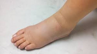 Swelling in feet can increase the risk of this serious disease! pay attention immediately