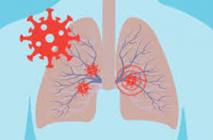 Lungs take 3 months to recover well after Covid recovery, Study