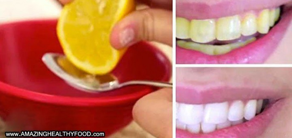 Use these natural things to keep your teeth clean
