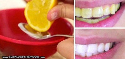 दांतों को साफ रखने के लिए इन प्राकृतिक चीजों का करें इस्तेमाल