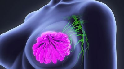 Check out the list of foods that can cause breast cancer