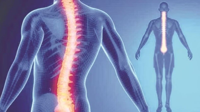 World Spine Day: Stop These Spine-Hurting Mistakes