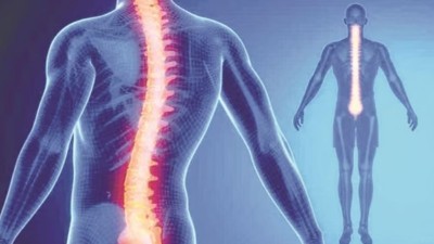 World Spine Day: Stop These Spine-Hurting Mistakes