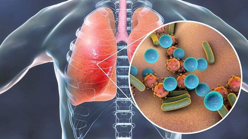 Do not overlook TB disease, it can affect other parts of the body as well as the lungs