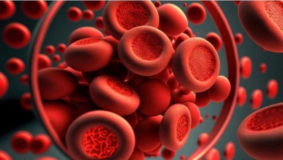 Are You Battling Anemia or Hemochromatosis? Know Main Foods to Keep Up Healthy