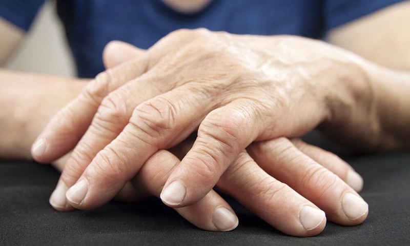 Understanding Rheumatoid Arthritis Symptoms