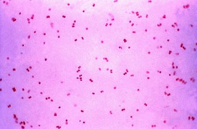Understanding Meningococci: The Contagious Bacteria