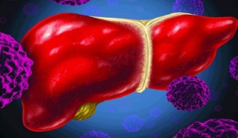 Molecular relationship between diabetes and fatty liver disease: IIT Study
