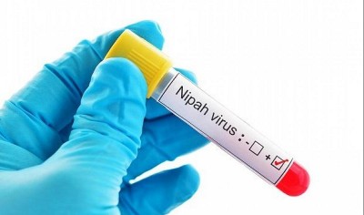 केरल में निपाह वायरस के सभी मरीजों की रिपोर्ट हुई नेगिटिव