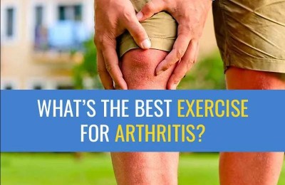 Physiotherapy: A Vital Tool in Arthritis Management and Prevention