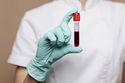 Everything You Should Know About Blood Tests and How They Help