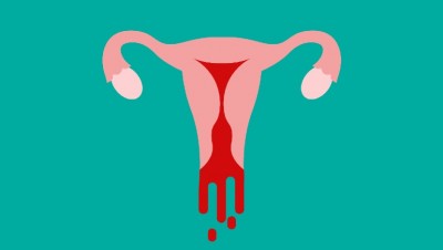 Vaginal Bleeding After Sex: Understanding the Causes