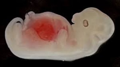 Can human kidney develop in pig embryo? Know what is kidney transplant?