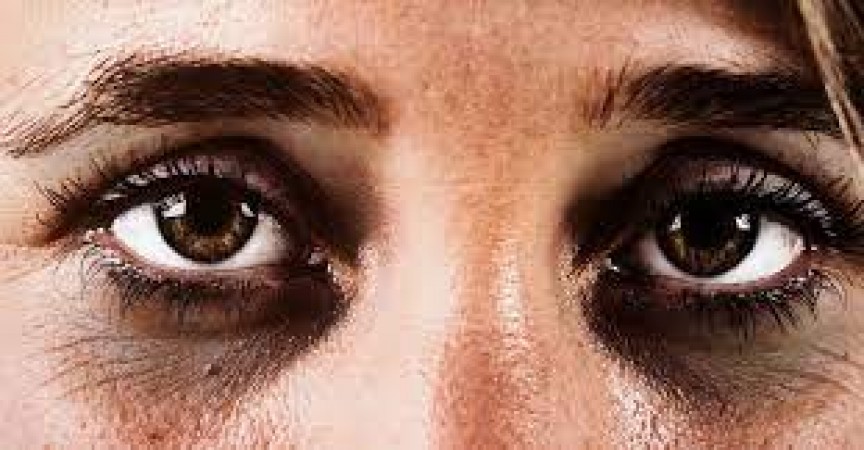 If dark circles appear under the eyes or hair starts appearing on the face, be alert, your face is telling about your health