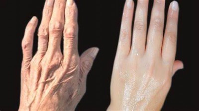 Wrinkles of hands will go away, just adopt this home method, difference will be visible in 10 days