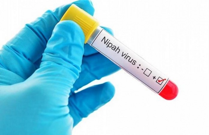 अमेरिका के वैज्ञानिकों ने  विकसित किया निपाह वायरस का  टीकाकरण