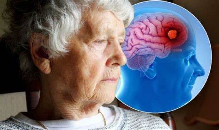 There are 5 crore Alzheimer's patients worldwide, lack of memory and forgetting the way are major symptoms, these steps should be taken first