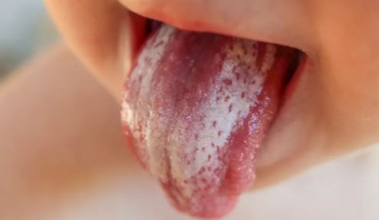 अगर आपके मुंह में हाथ-पैरों में झनझनाहट होने के साथ-साथ छालों से भरा हुआ है तो आपको इस विटामिन की है कमी