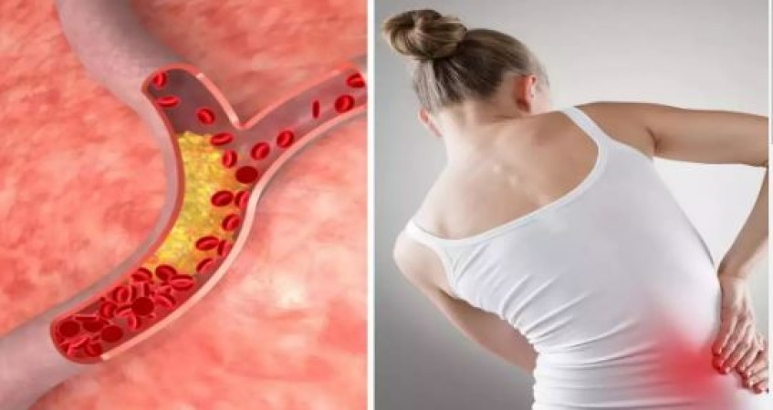 High cholesterol is becoming a silent killer, these symptoms appear in the body as it increases