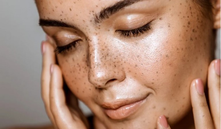Apply these household things to keep your face always fresh, the glow can come back