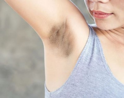 Get rid of dark underarms with this thing