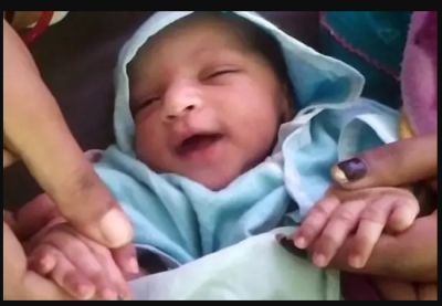 नवरात्रि पर हुआ अनोखी बच्ची का जन्म, हाथ और पैर पर है होश उड़ा देने वाले निशान