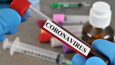 Coronavirus test to be conducted in 87 private labs, See complete list