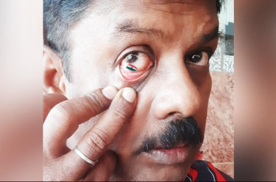 OMG! Man made 'Tiranga' inside eye, gave this warning by sharing picture